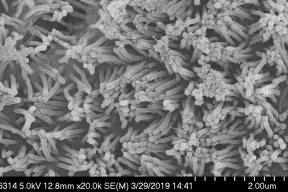 2020-Intestinal-brush-border-2-um-850px