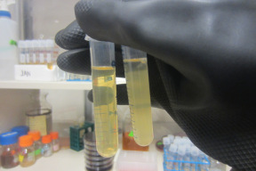 Bacteria_holding_tubes