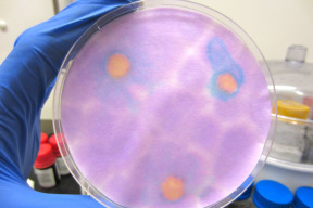 Holding_multicolored_petri_dish